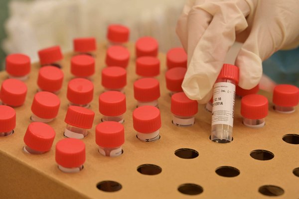 鴨脷洲邨利滿樓檢19宗陽性個案