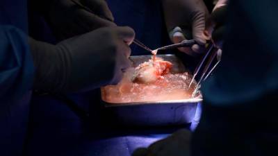 us-surgeons-transplant-pig-kidney-to-live-patient-in-world-first