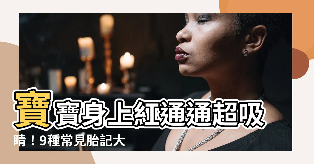 【胎記紅色】寶寶身上紅通通超吸睛！9種常見胎記大解密