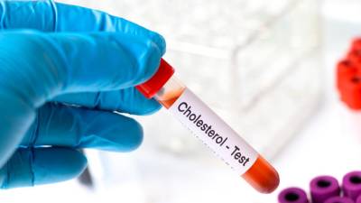 what-you-should-know-about-cholesterol