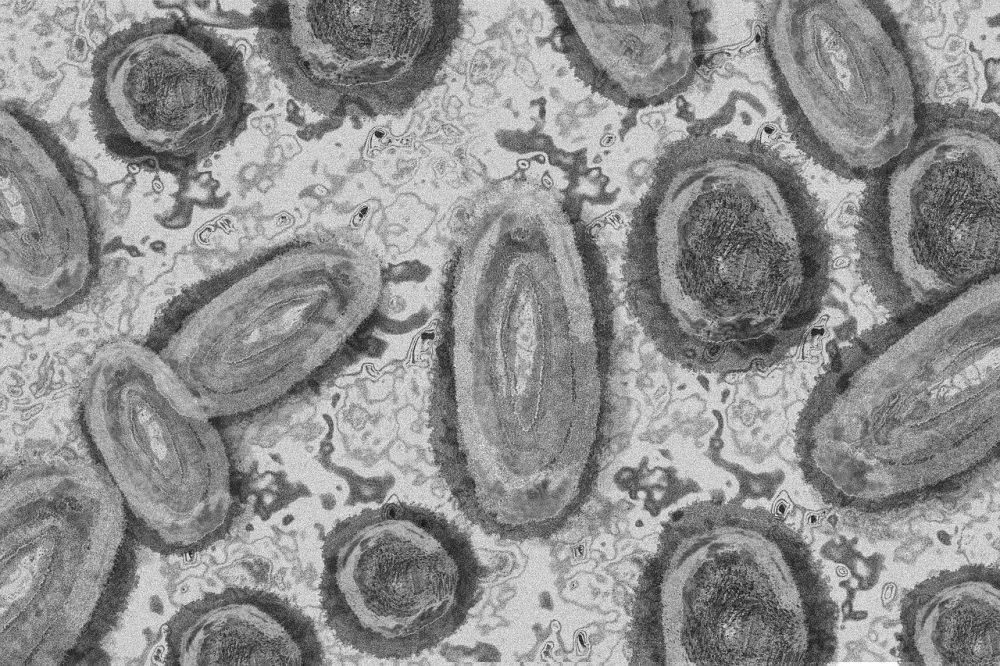9-mpox-cases-detected-in-malaysia-last-year