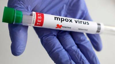 mpox-is-not-the-new-covid,-says-who-official