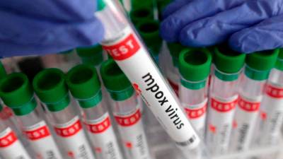 us-fda-approves-emergent’s-smallpox-vaccine-for-people-at-high-risk-of-mpox